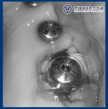 곡반정동치과