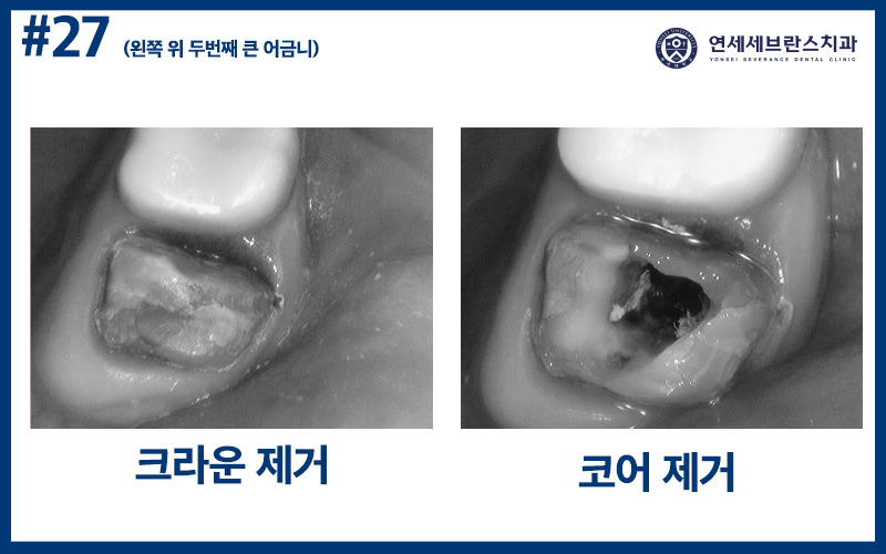 곡반정동치과