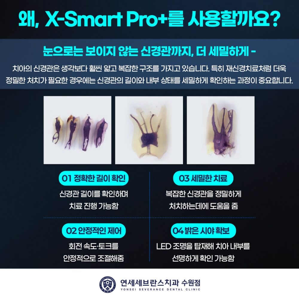 X-Smart Pro+